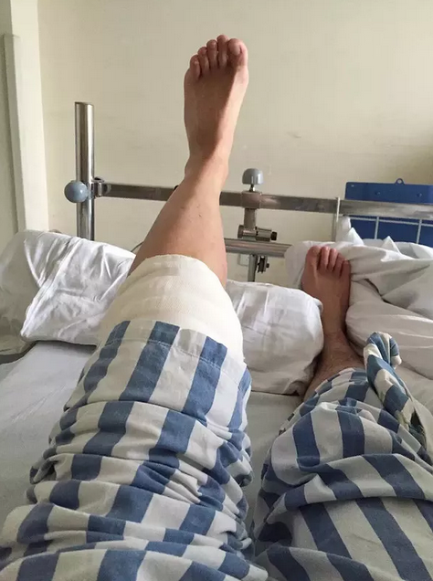 甚至抬腿